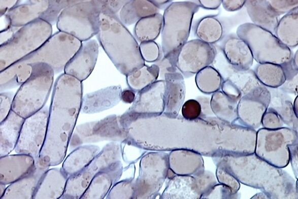 Qelizat e mykut të thonjve nën një mikroskop