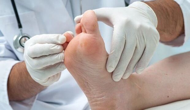 trajtimi dhe diagnostikimi i kërpudhave nga një mjek