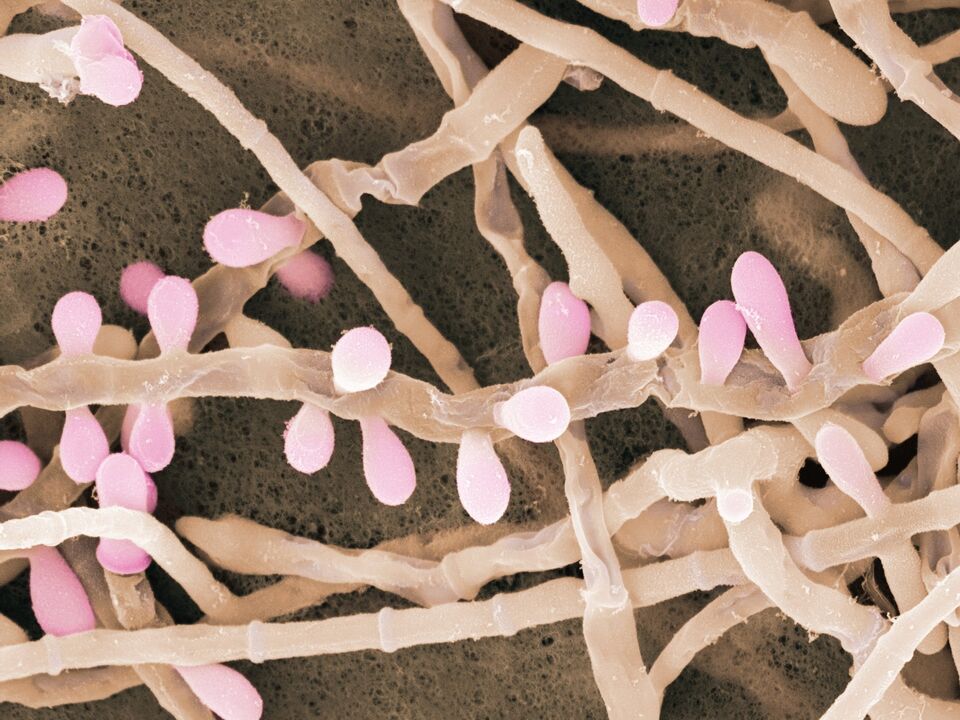 Trichophyton rubrum është një lloj myku që prek lëkurën e këmbëve.